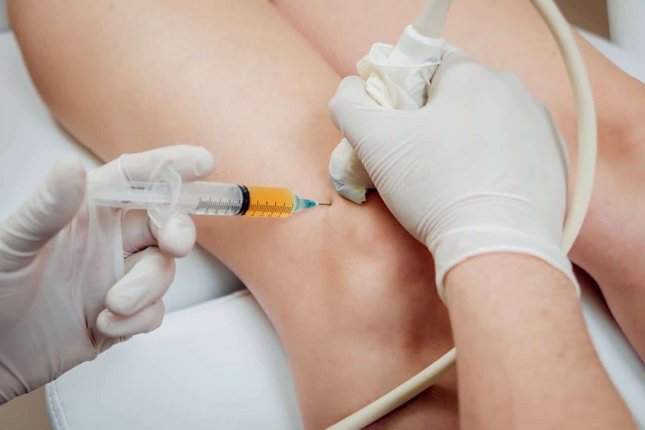 a person getting an ultrasound-guided platelet-rich plasma injection of the knee
